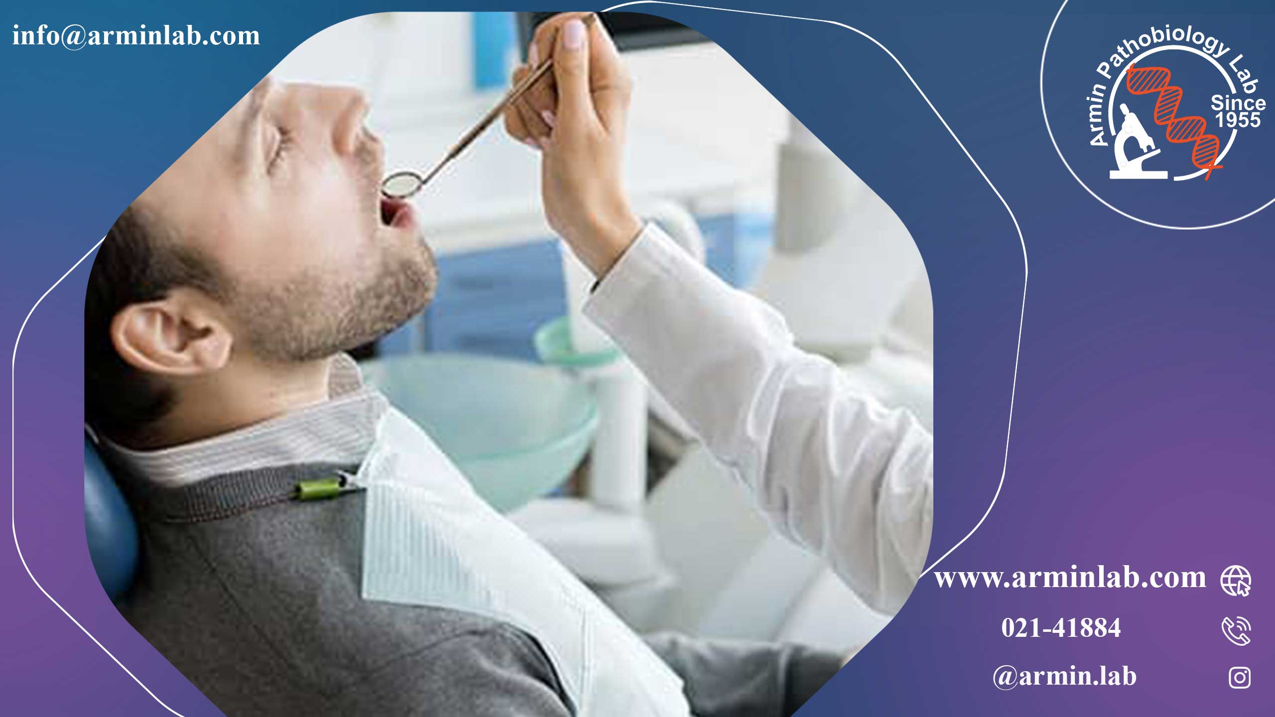 تحلیل لثه چیست؟