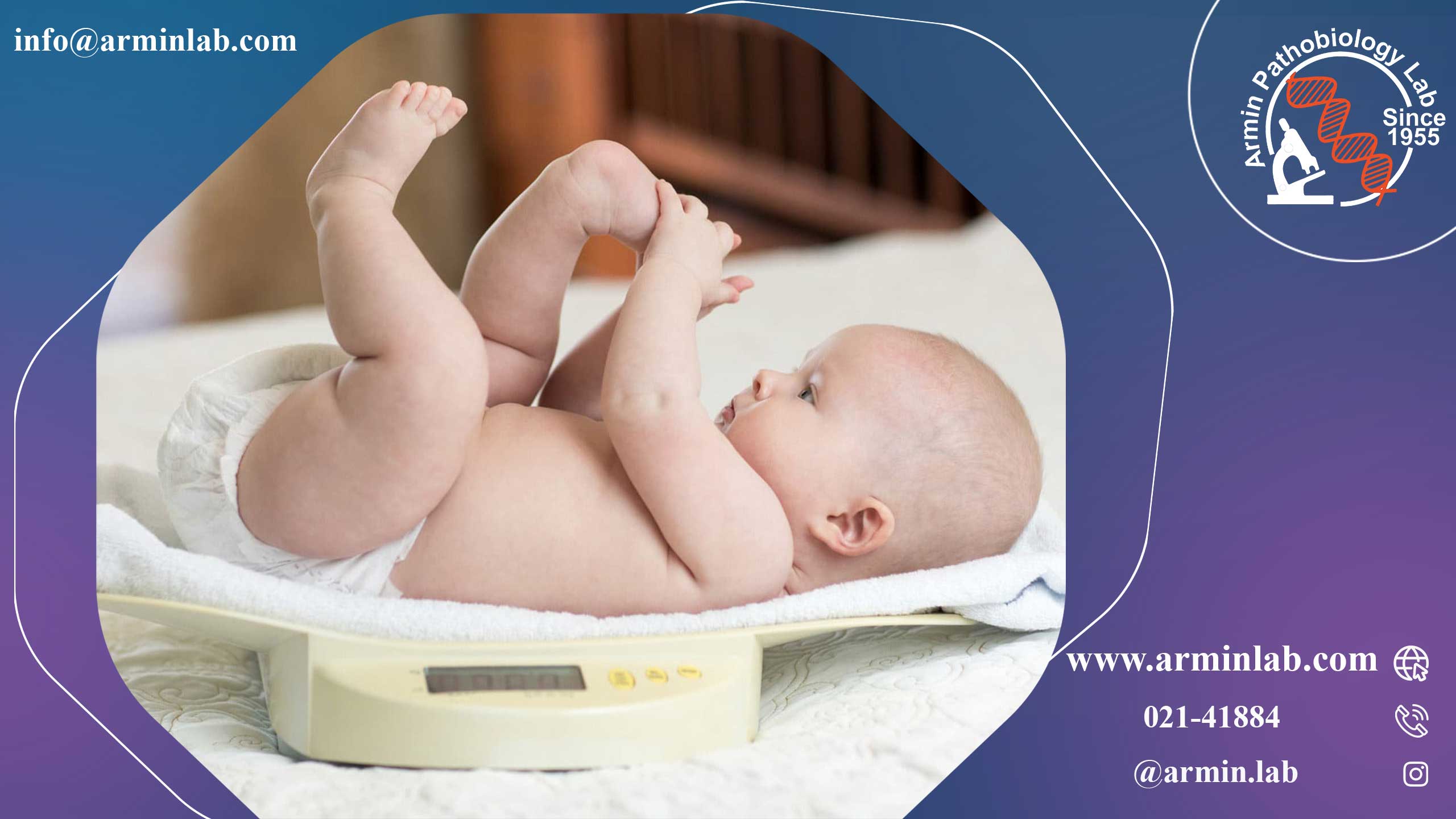 تولد نوزاد با وزن کم