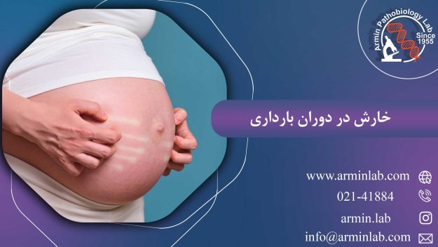 خارش در دوران بارداری