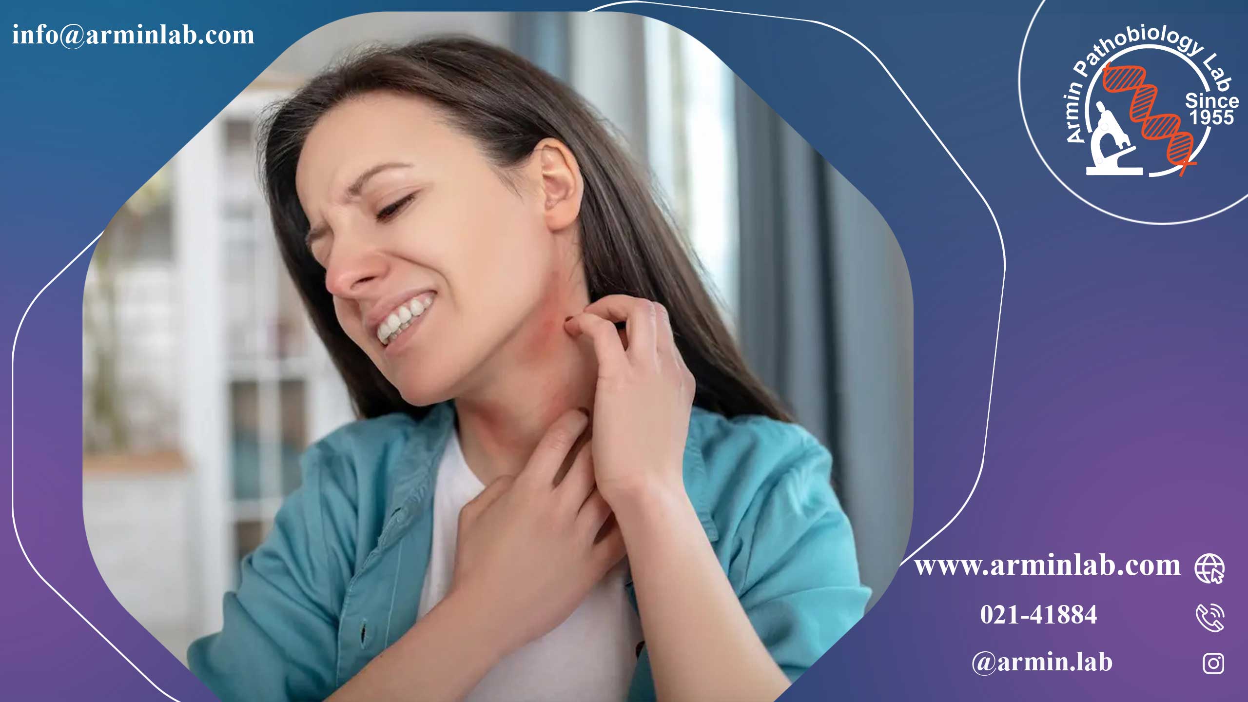 خارش در دوران بارداری