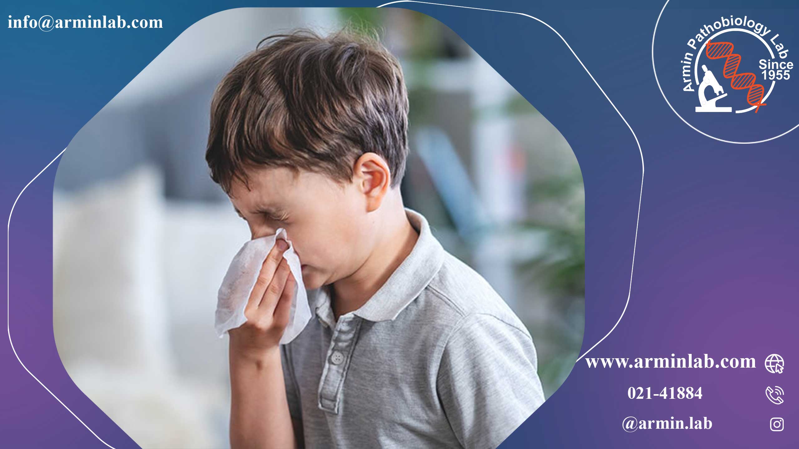 عفونت دستگاه تنفسی فوقانی (URI)