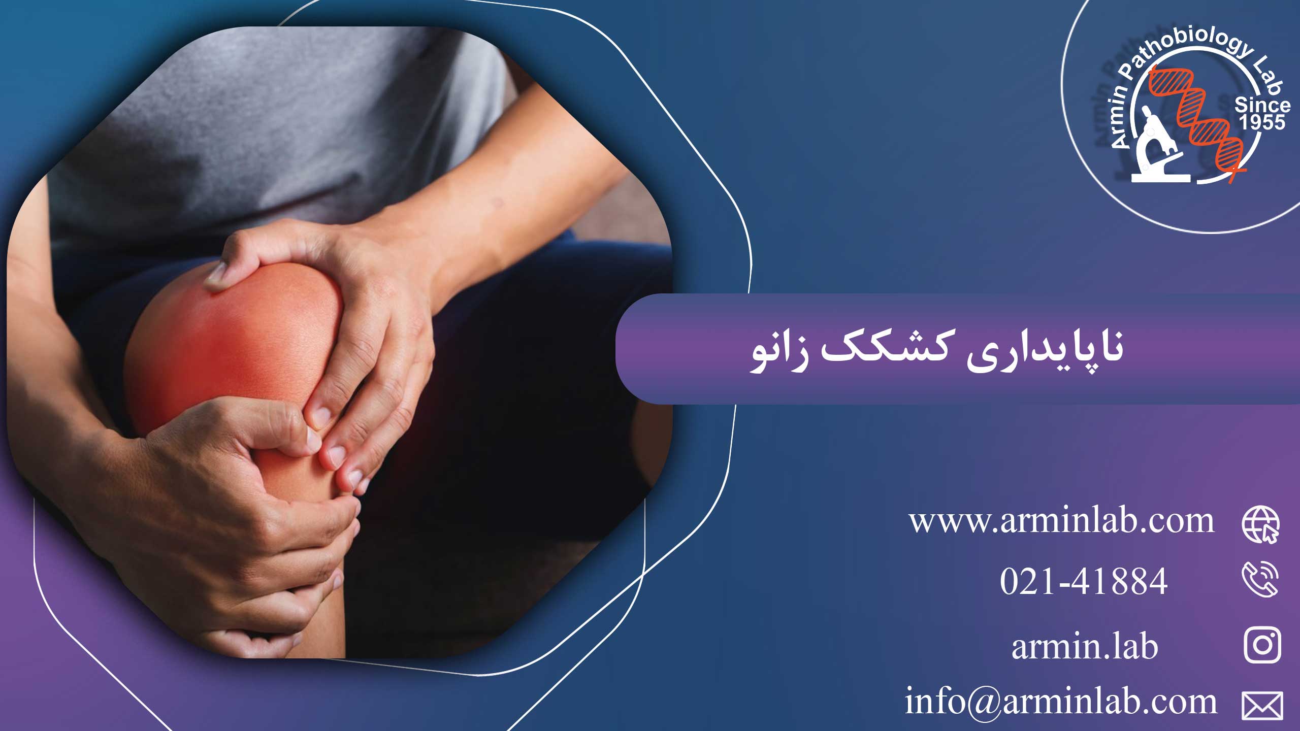 ناپایداری کشکک زانو