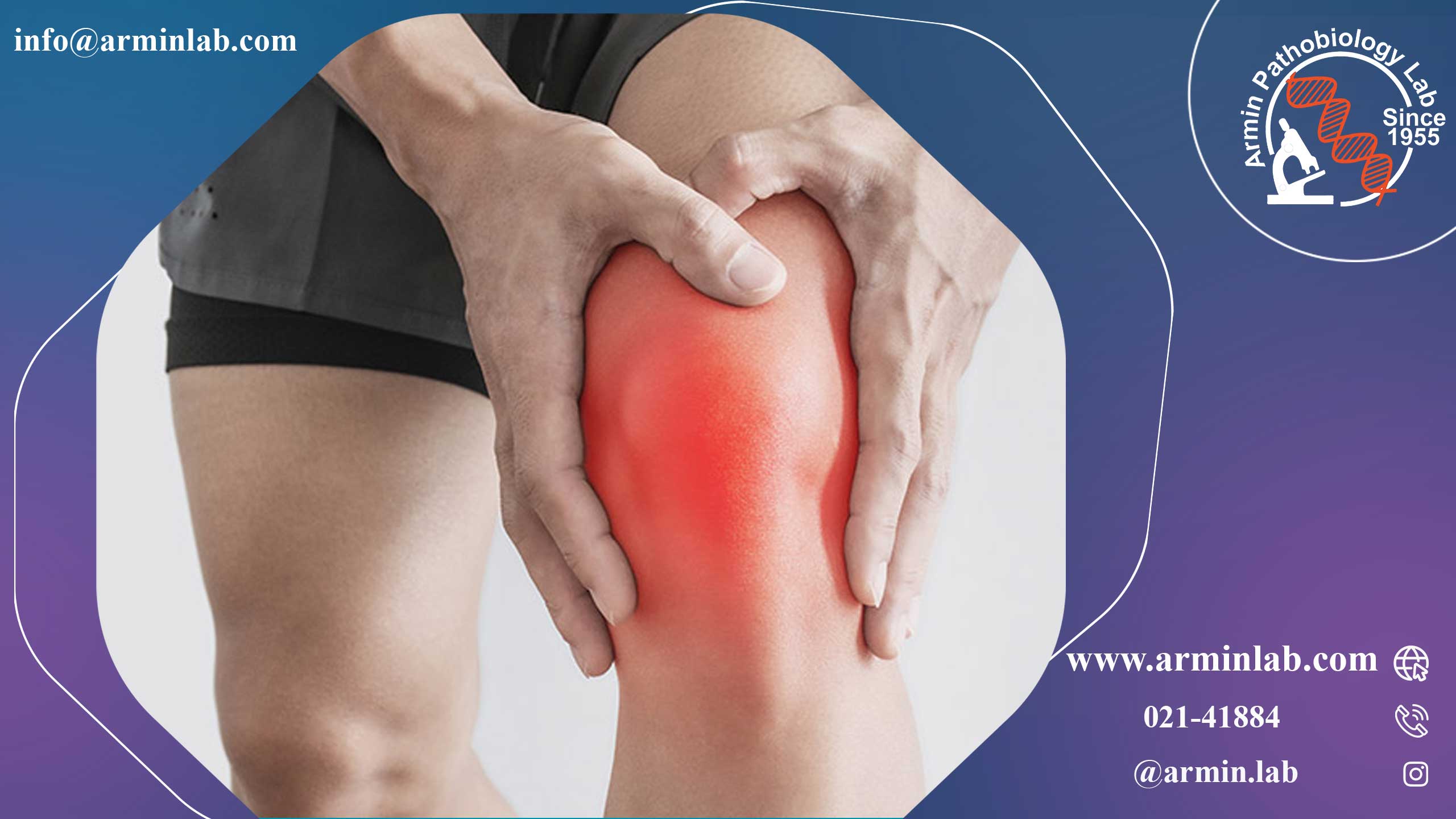 ناپایداری کشکک زانو