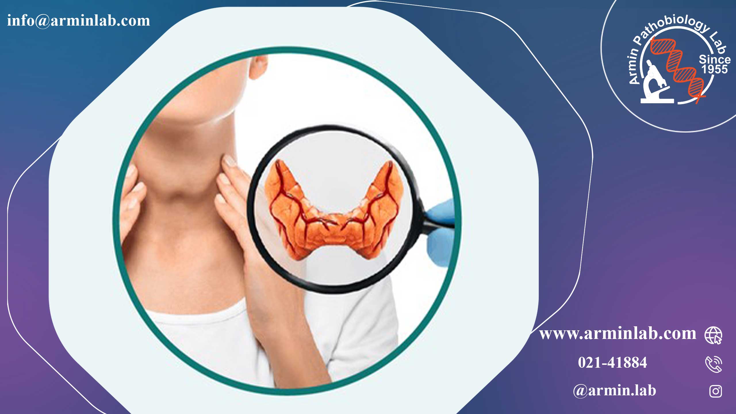 کم‌کاری تیروئید در کودکان