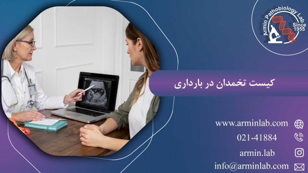 کیست تخمدان در بارداری