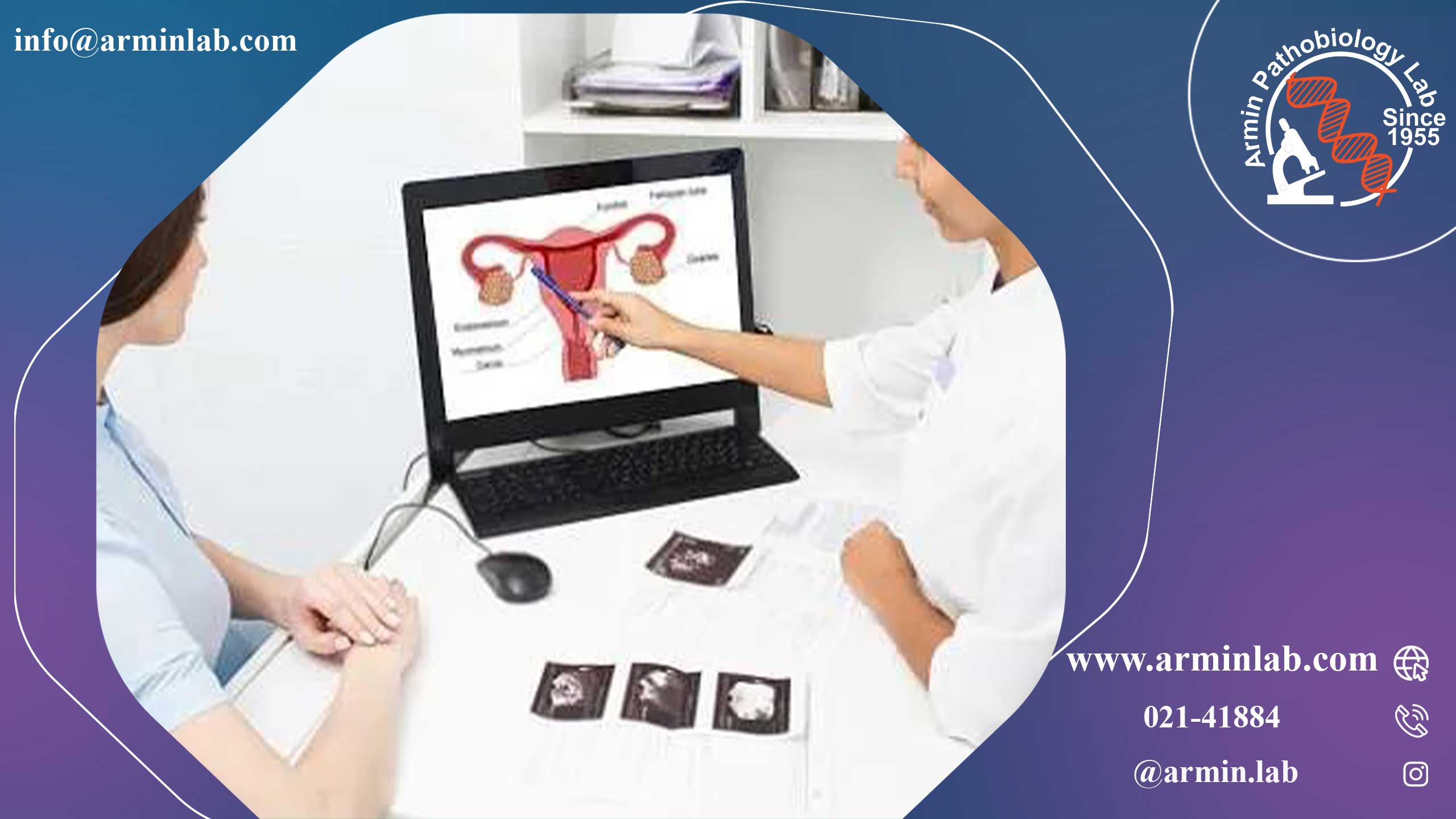 کیست تخمدان در بارداری