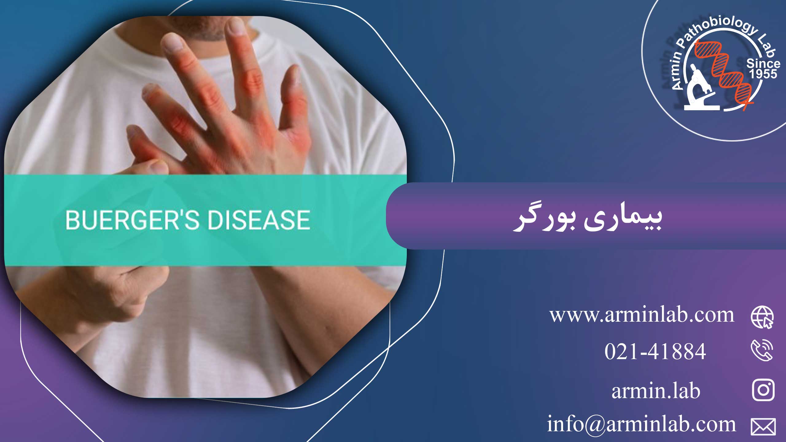 بیماری بورگر