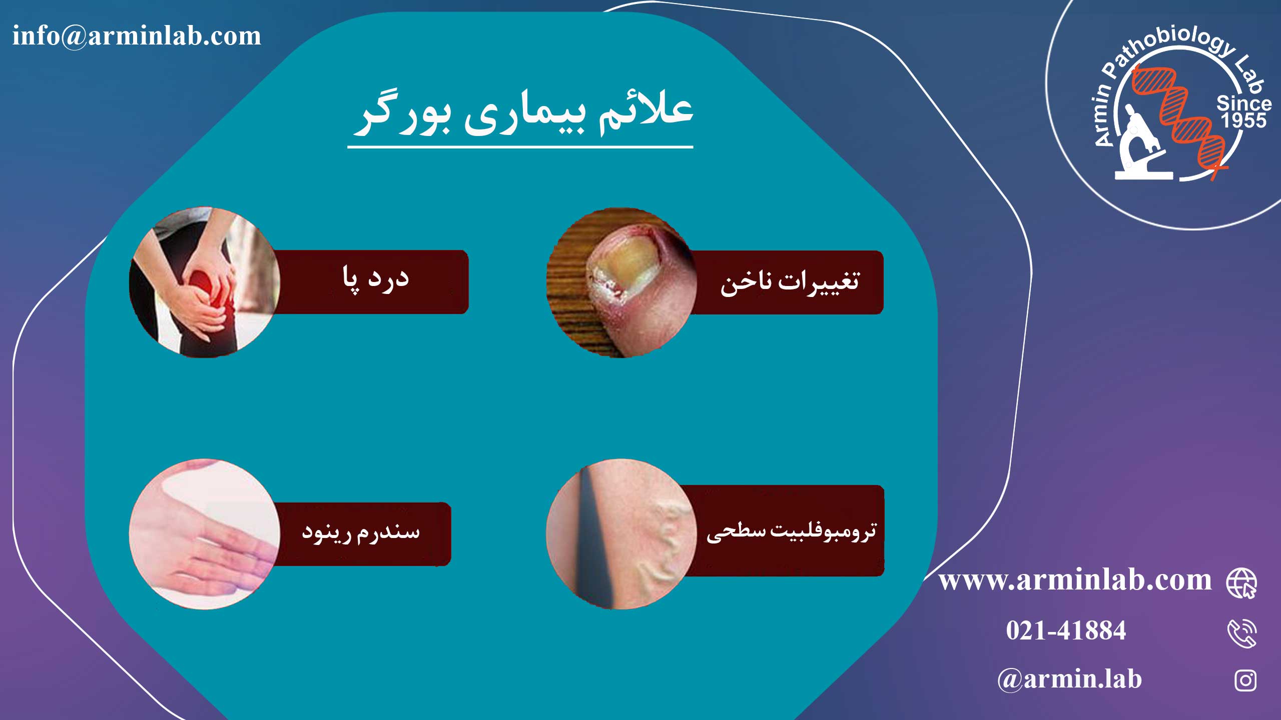 بیماری بورگر 