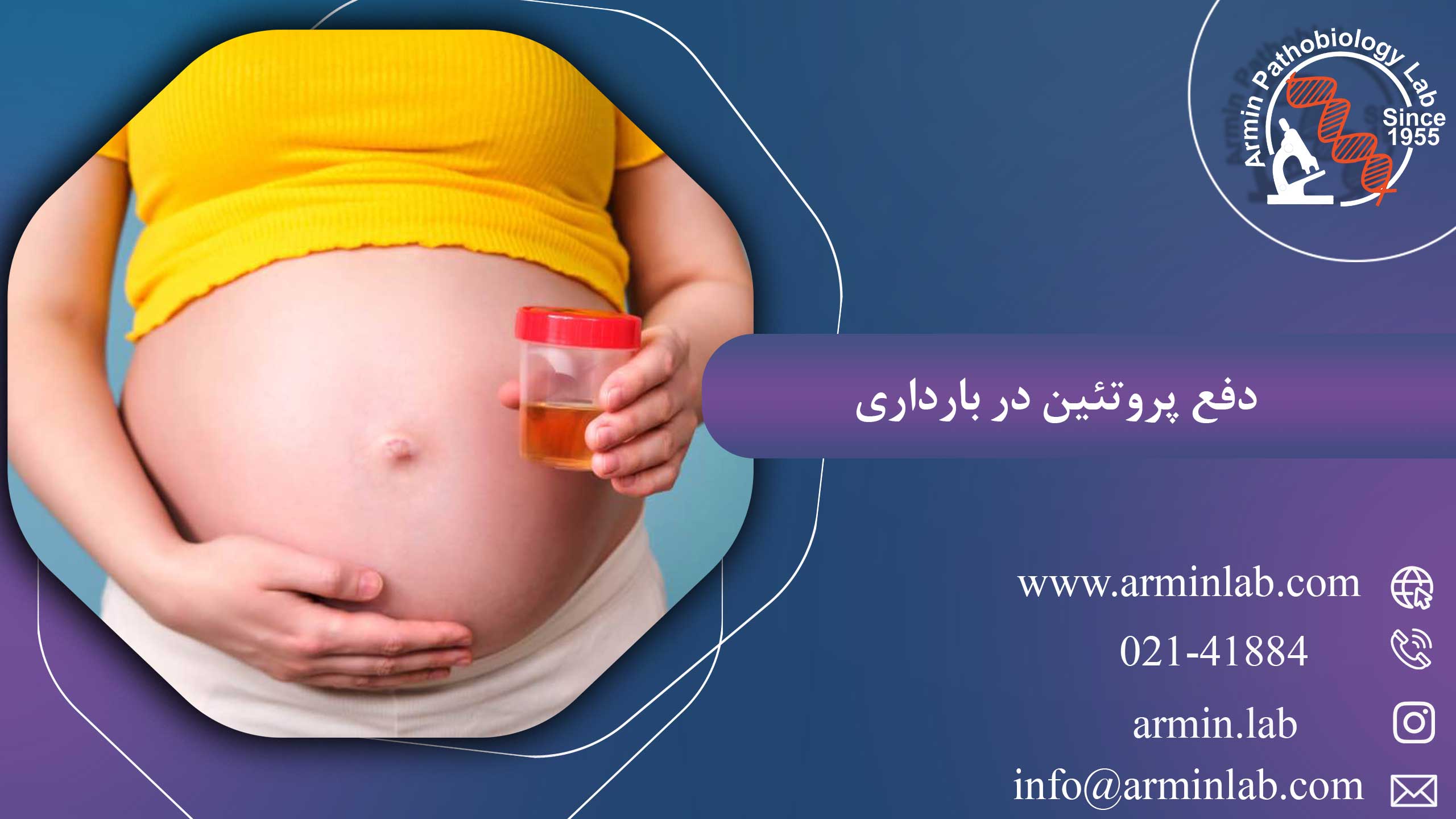 دفع پروتئین در بارداری