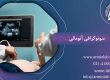 سونوگرافی آنومالی