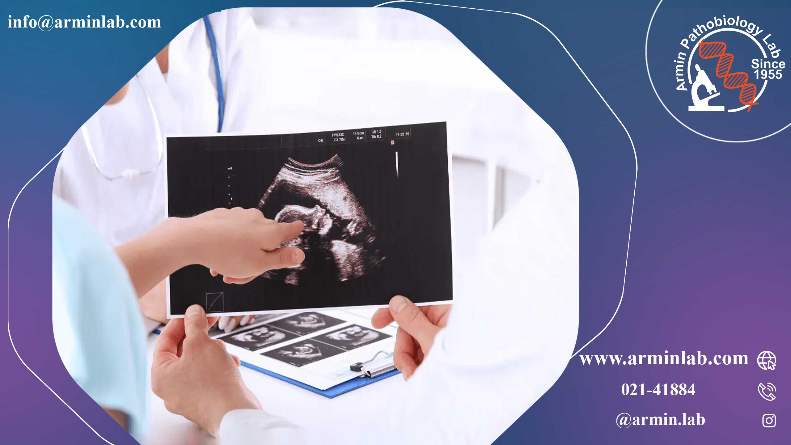 سونوگرافی آنومالی