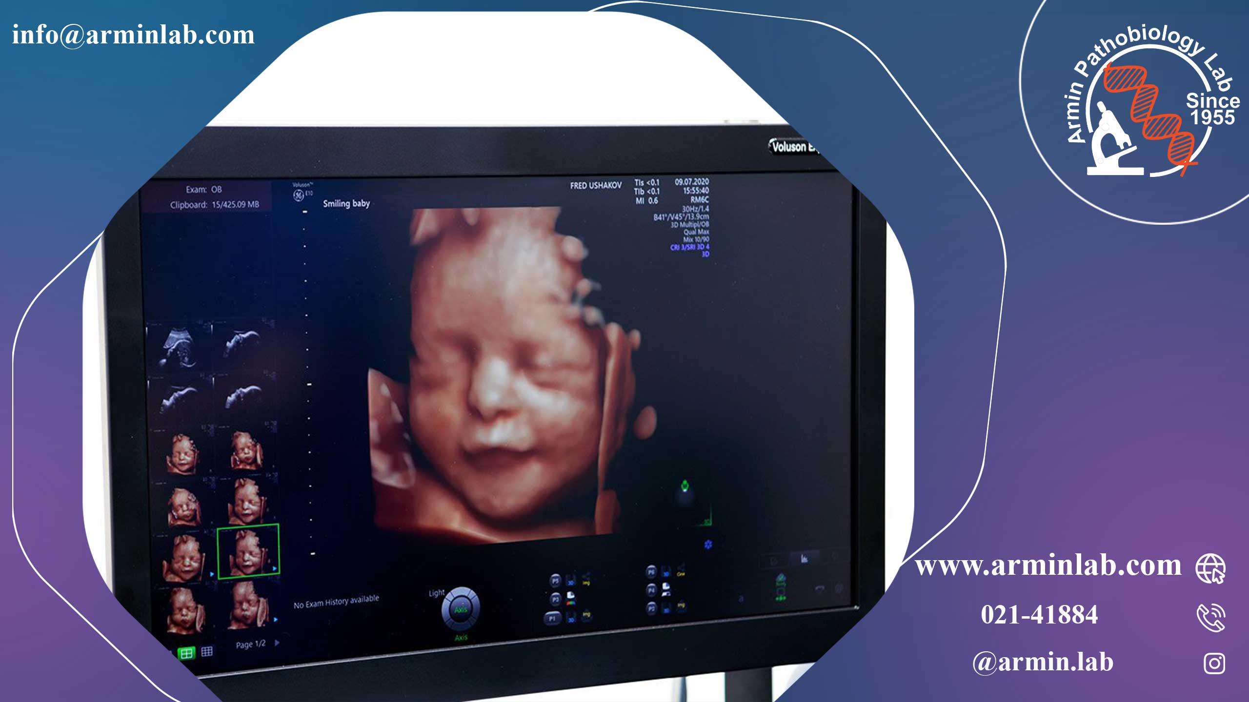 سونوگرافی آنومالی