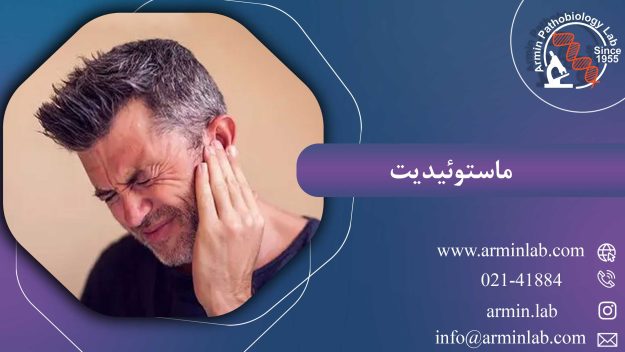 ماستوئیدیت