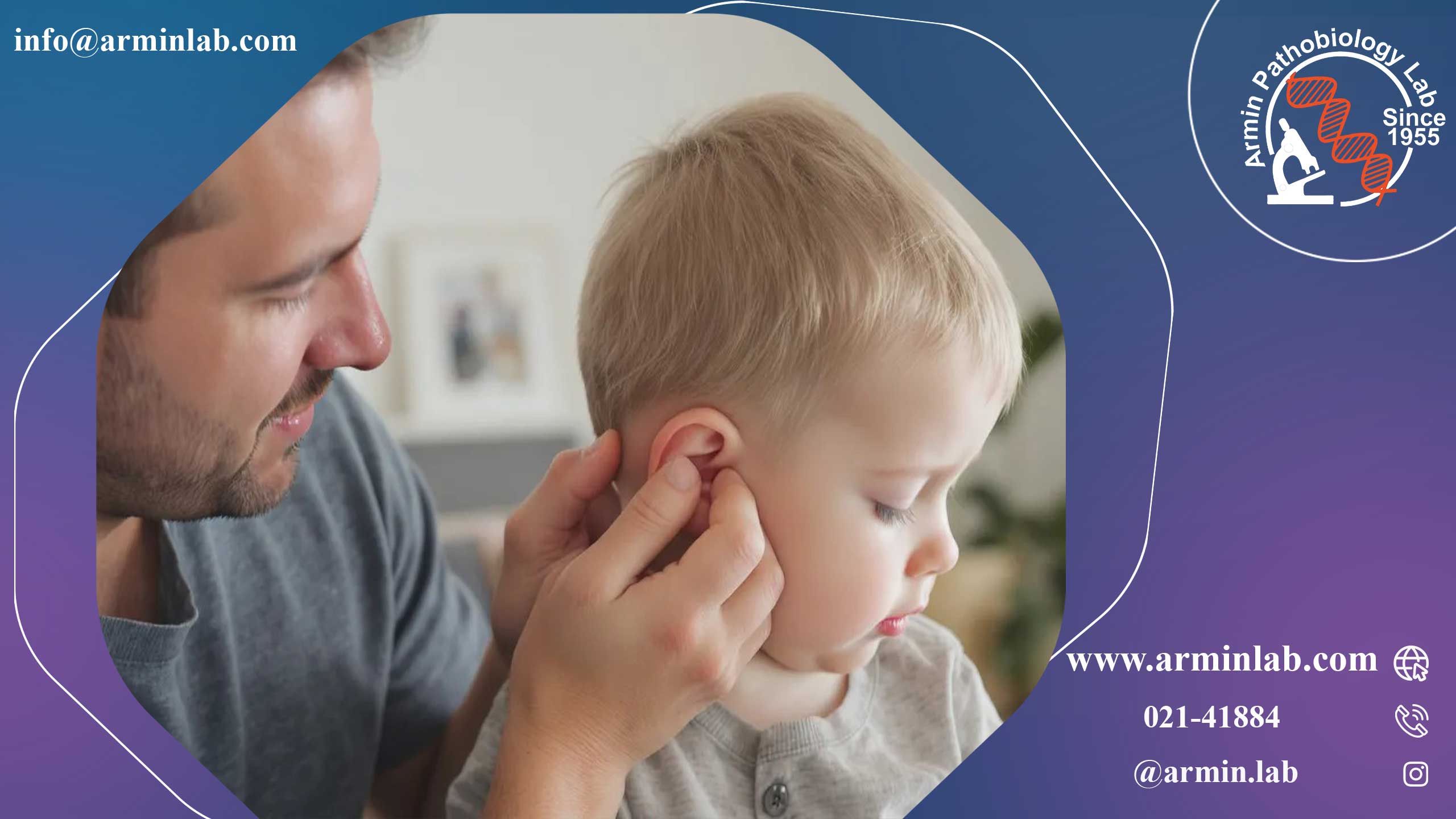 ماستوئیدیت