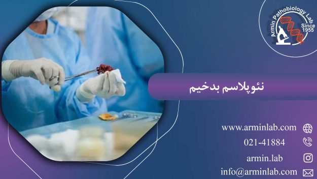 نئوپلاسم بدخیم