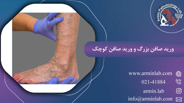 ورید صافن بزرگ و ورید صافن کوچک