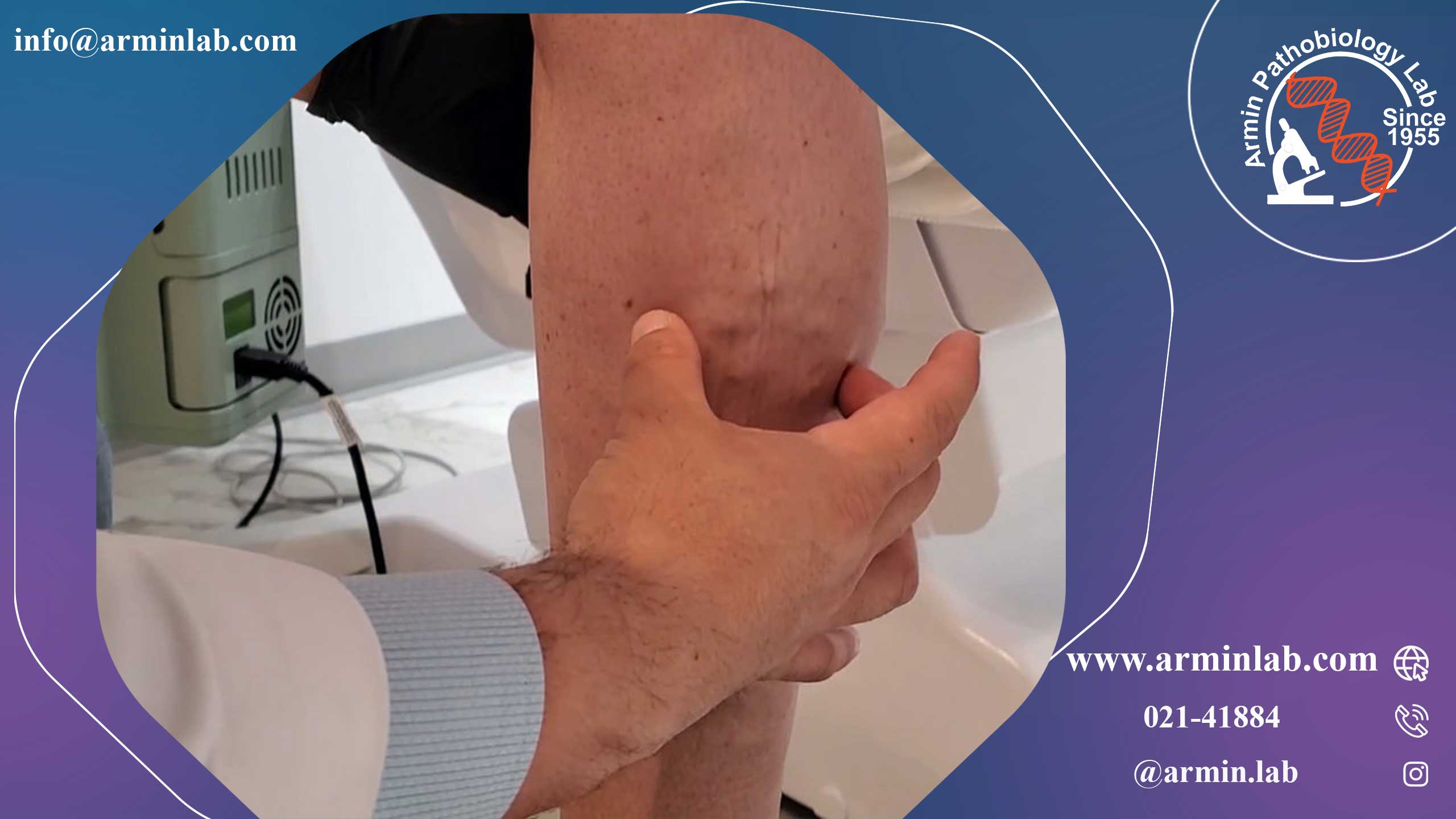 ورید صافن بزرگ و ورید صافن کوچک