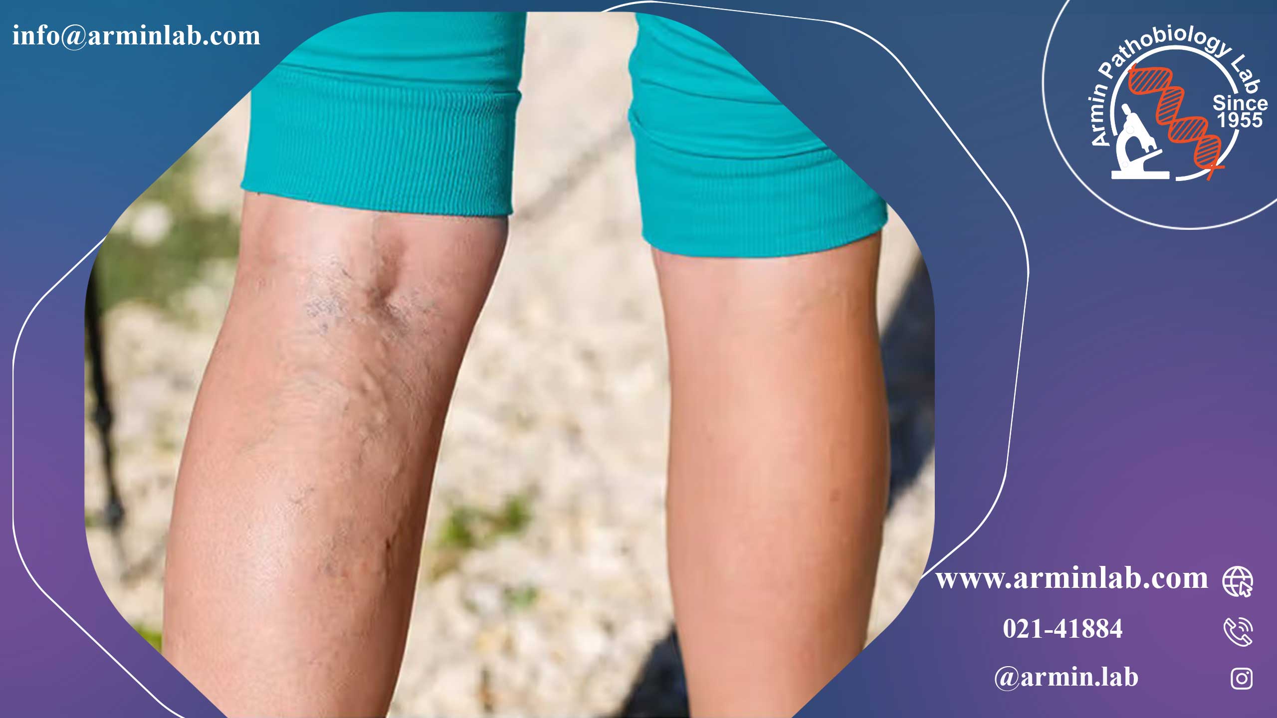 ورید صافن بزرگ و ورید صافن کوچک