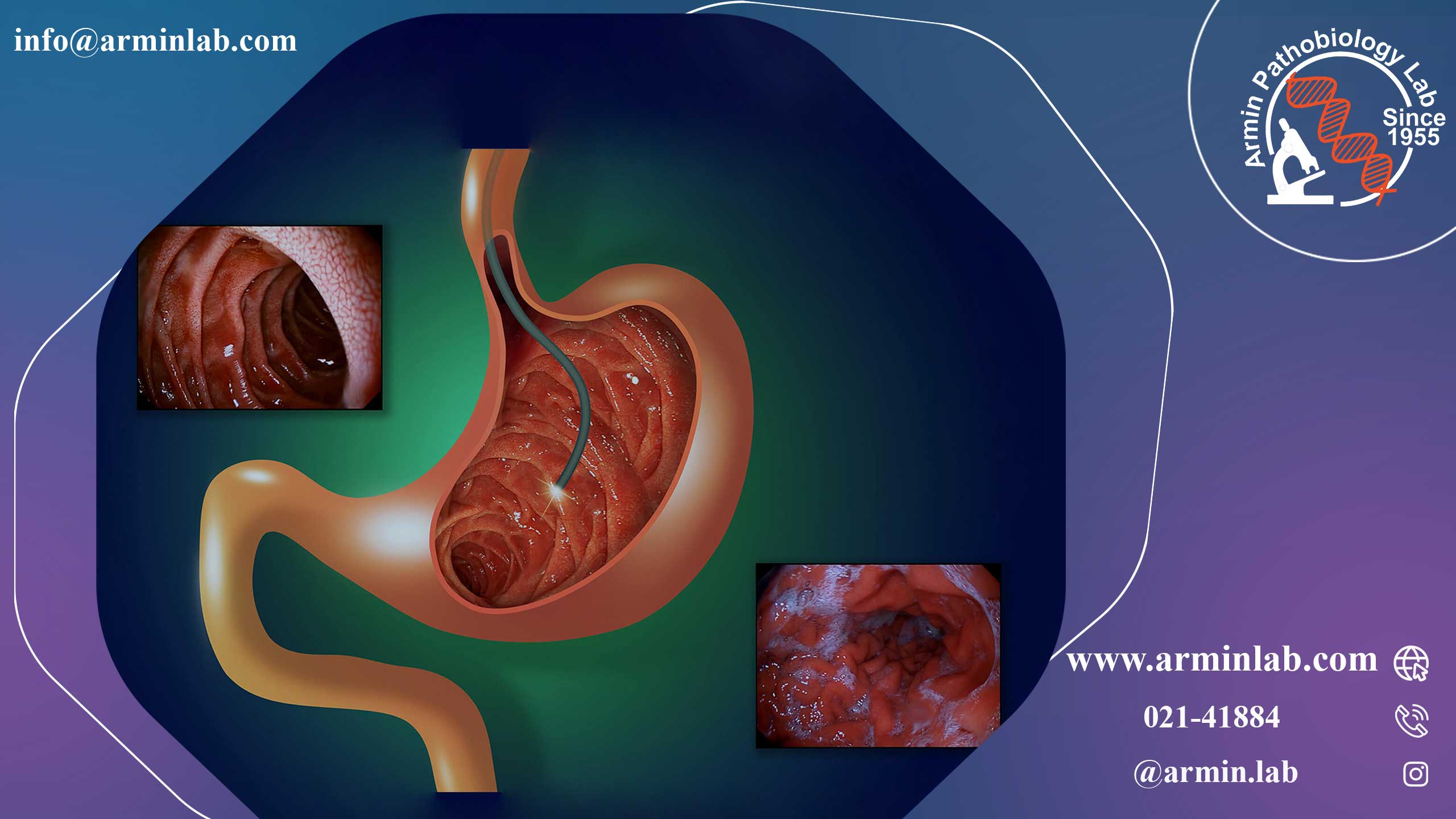 پارگی مالوری_ وایس