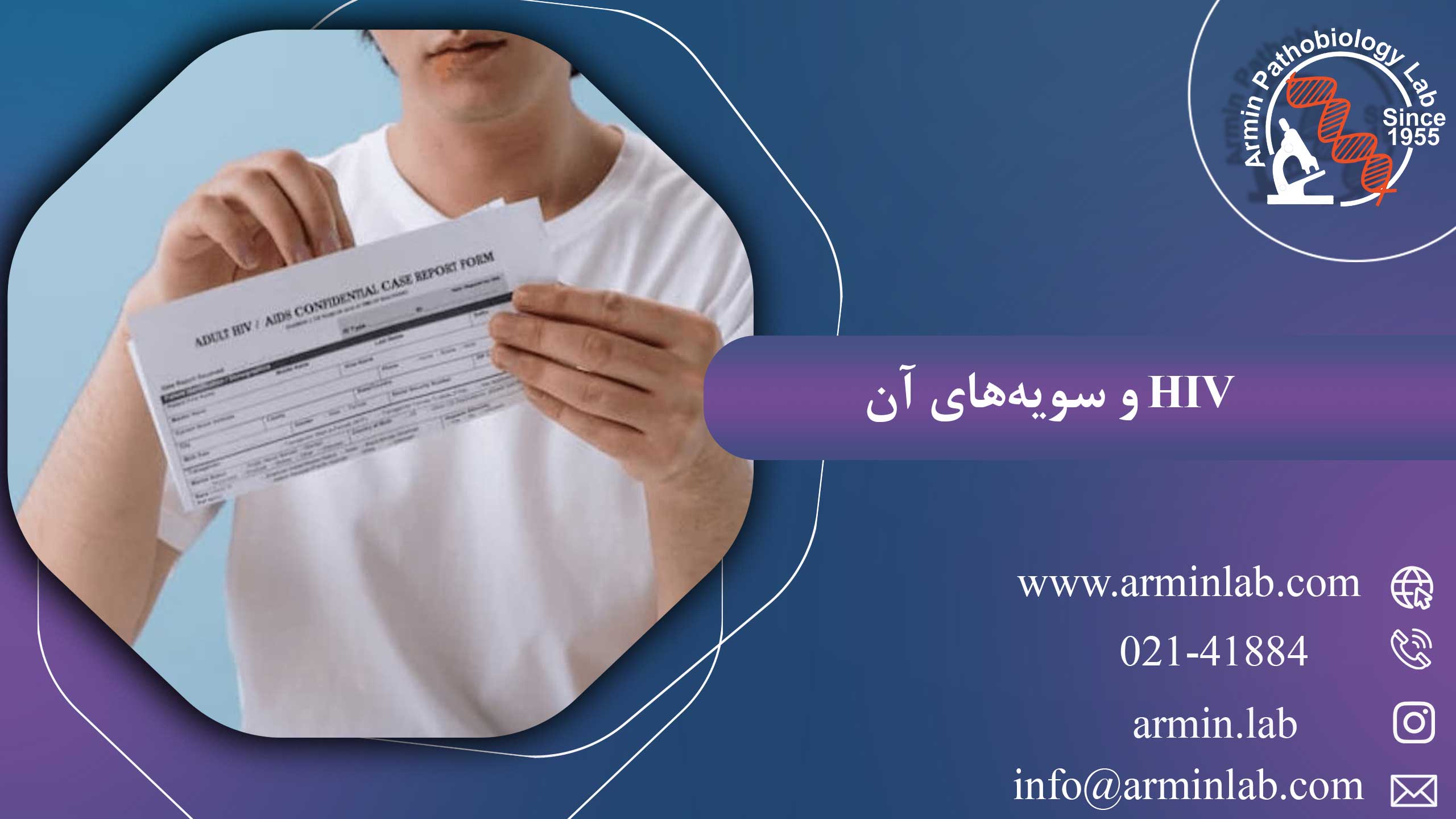 HIV و سویه های آن