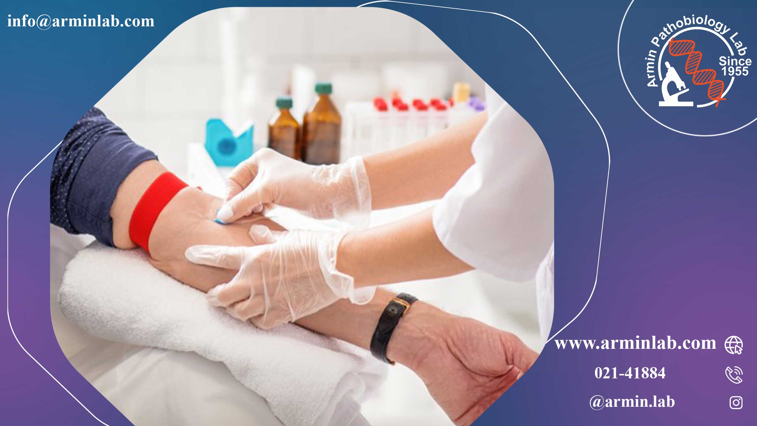 HIV و سویه های آن