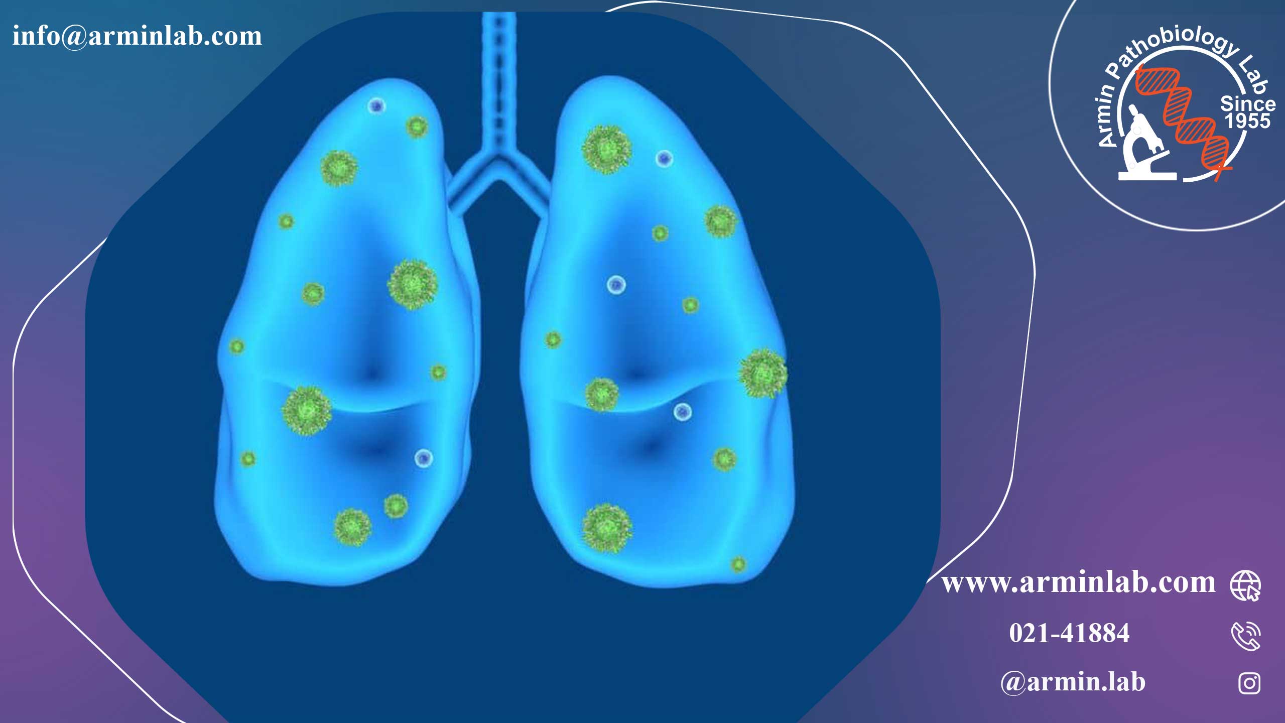 نوکاردیوز چیست؟