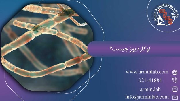 نوکاردیوز-چیست؟rminlab1 نوکاردیوز چیست؟