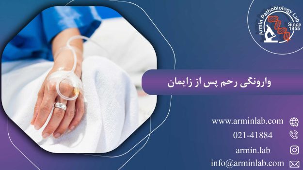 وارونگی رحم پس از زایمان