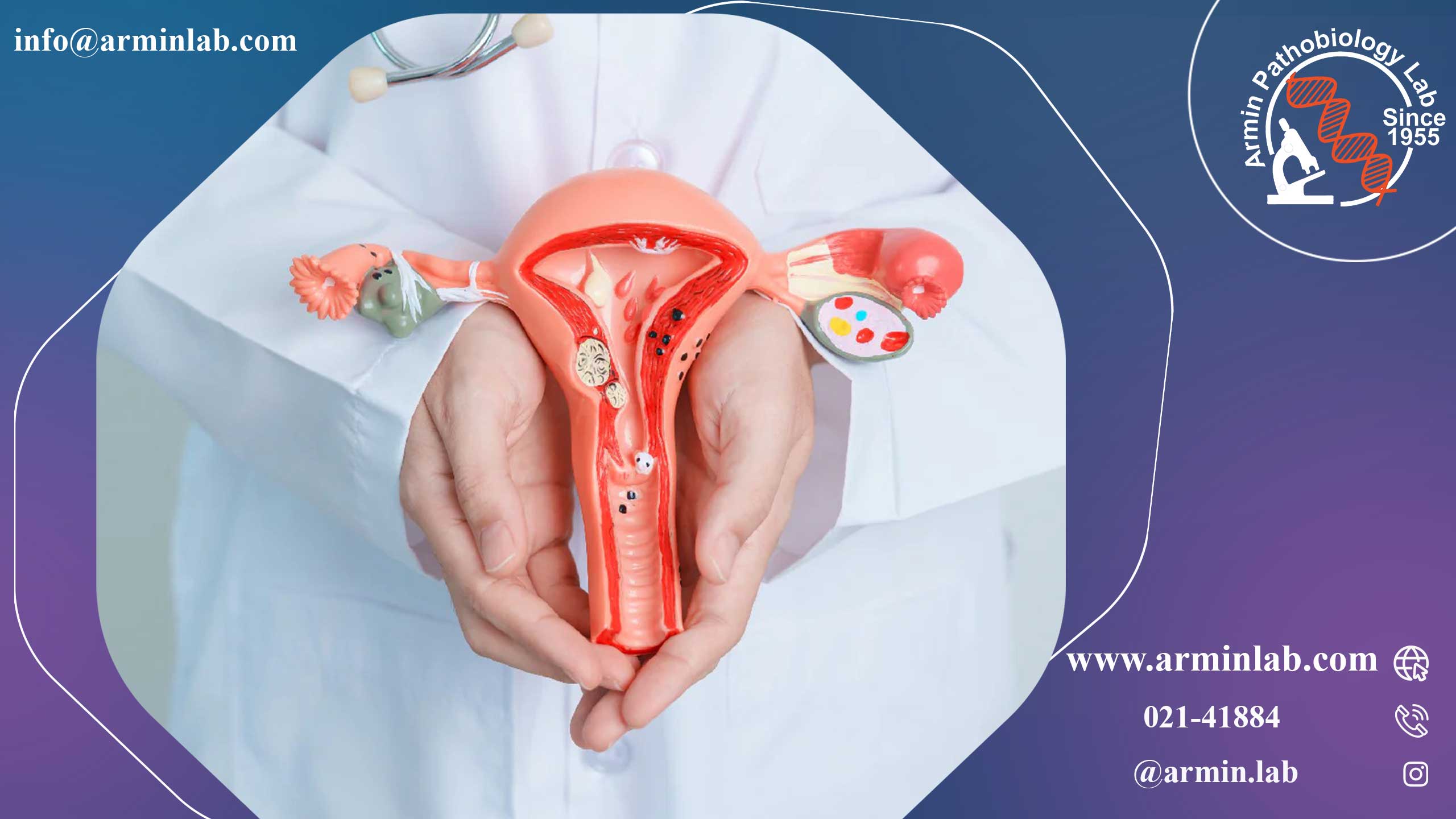 وارونگی رحم پس از زایمان