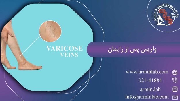 واریس-پس-از-زایمان-arminlab1 واریس پس از زایمان