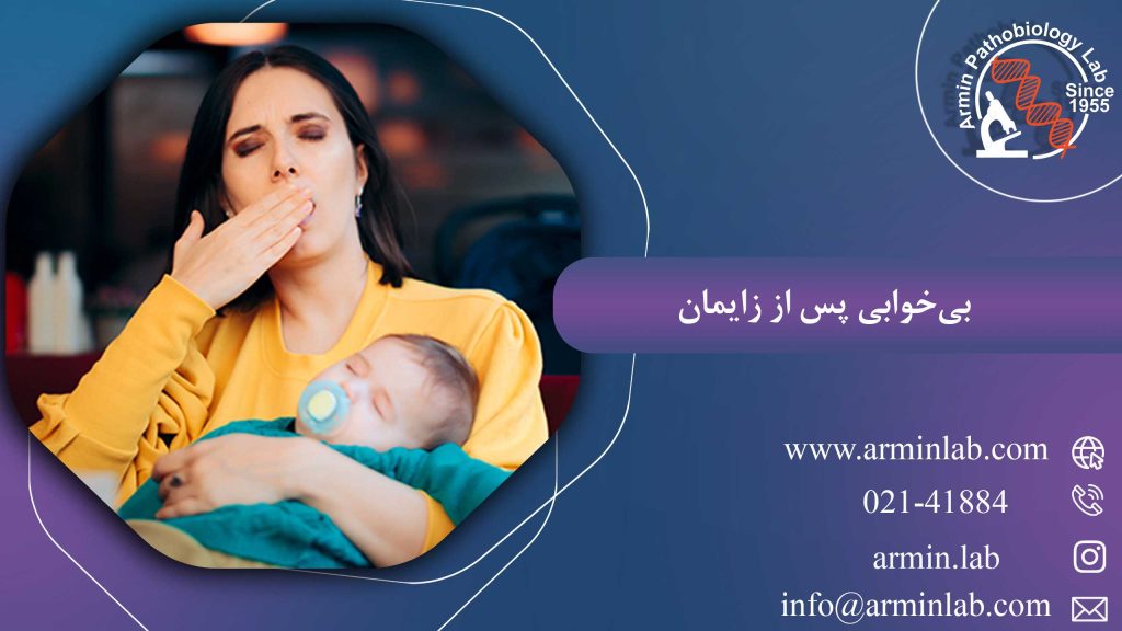 بی‌خوابی پس از زایمان