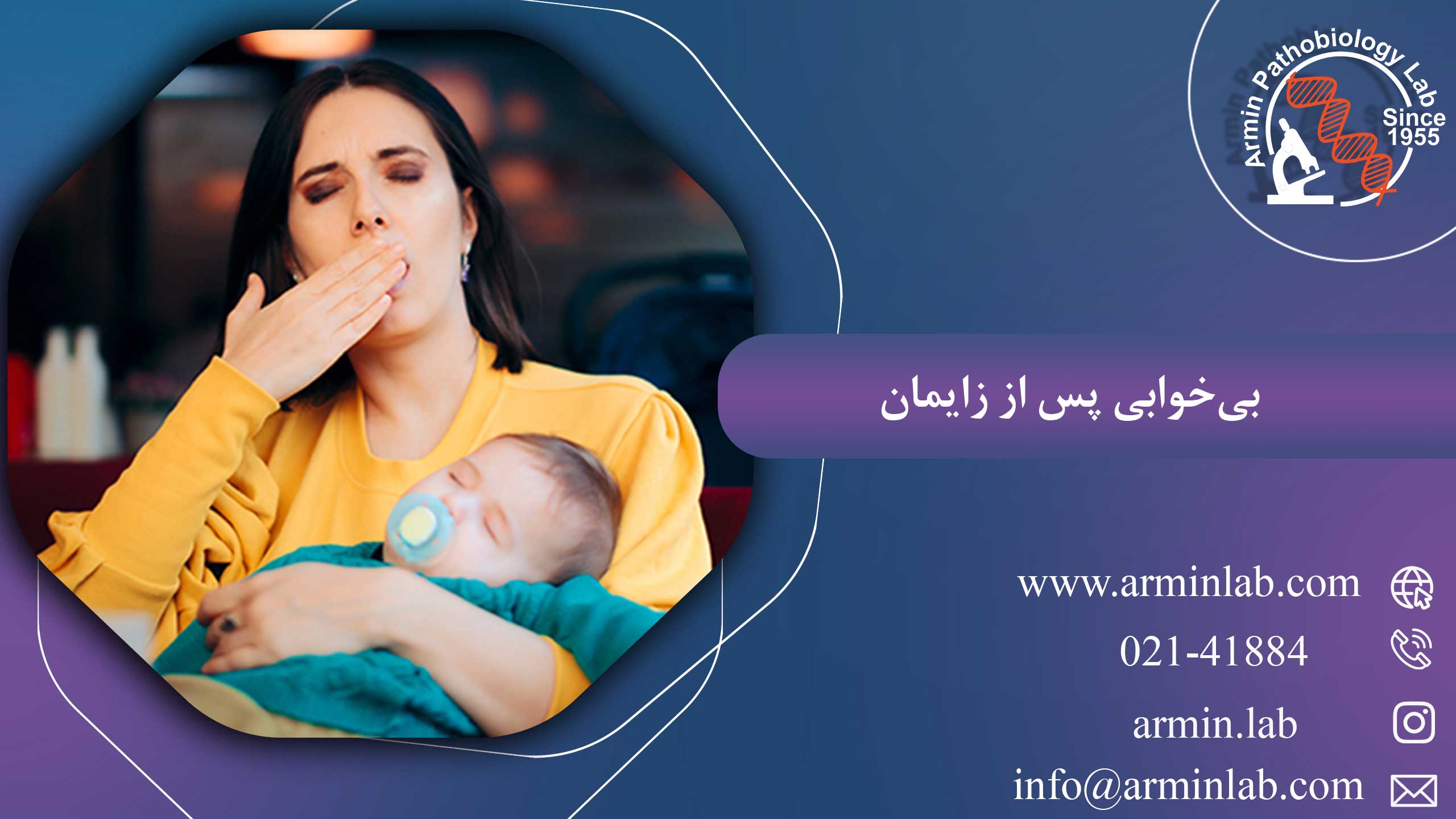 بی‌خوابی پس از زایمان