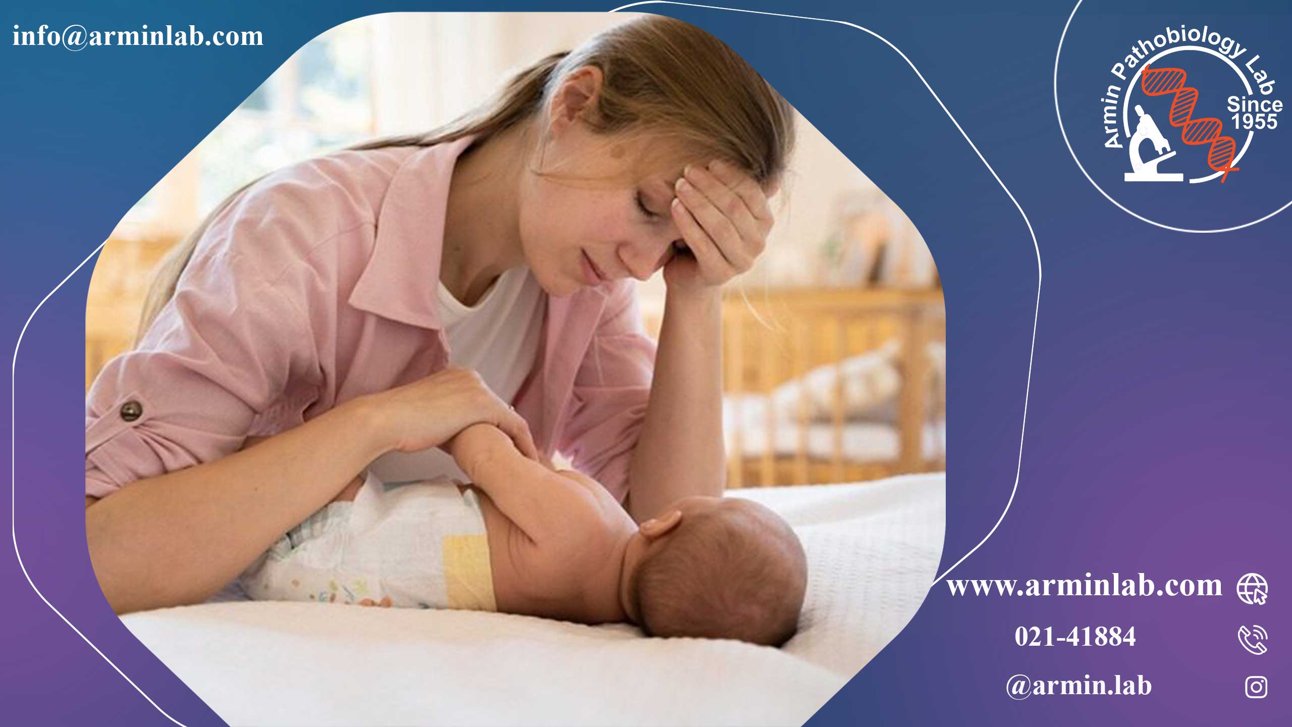 بی‌خوابی پس از زایمان 