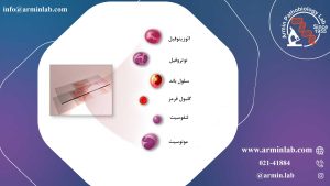 بالا بودن WBC در آزمایش خون