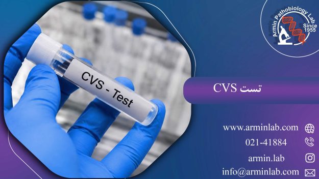 تست cvs