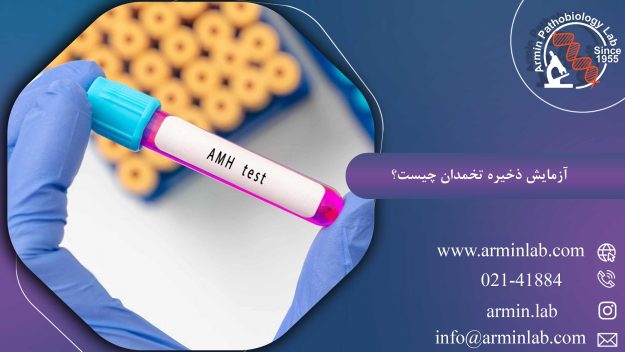 آزمایش ذخیره تخمدان