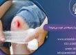 چرا زخم‌ها دیر خوب می‌شوند؟